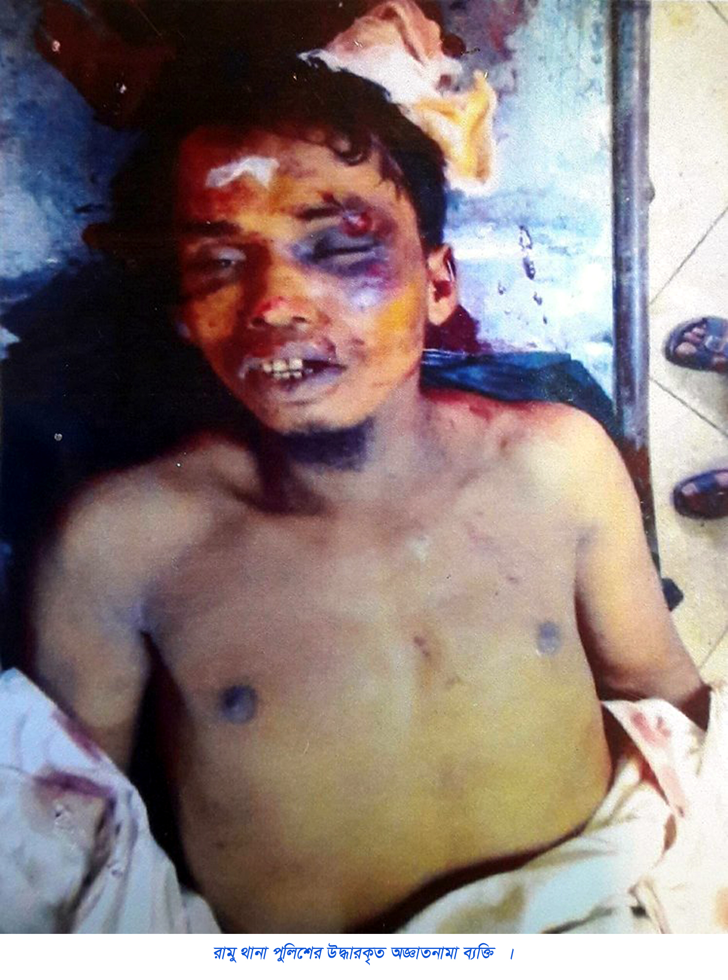 অজ্ঞাতনামা মৃত ব্যক্তির স্বজনদের সন্ধান চায় রামু থানা পুলিশ