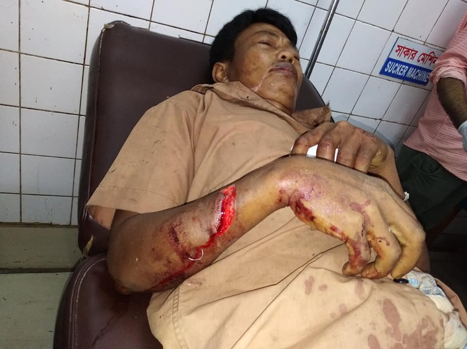 বৌদ্ধ সুরক্ষা পরিষদের ঘটনাস্থল পরিদর্শনঃ উখিয়ায় চাকমা আদিবাসীদের উপর হামলার ঘটনায় মামলা দায়ের