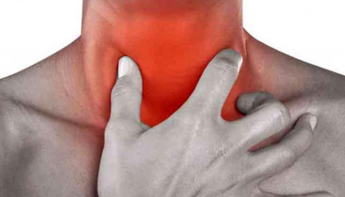 গলার ক্যানসারের প্রাথমিক লক্ষণ