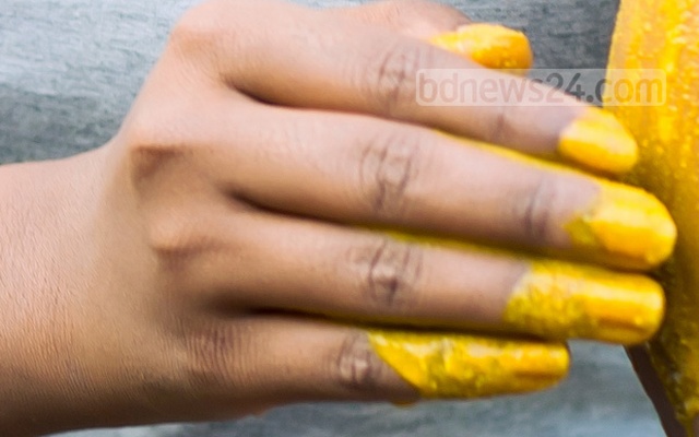 নখ হলুদ হওয়ার কারণ ও করণীয়
