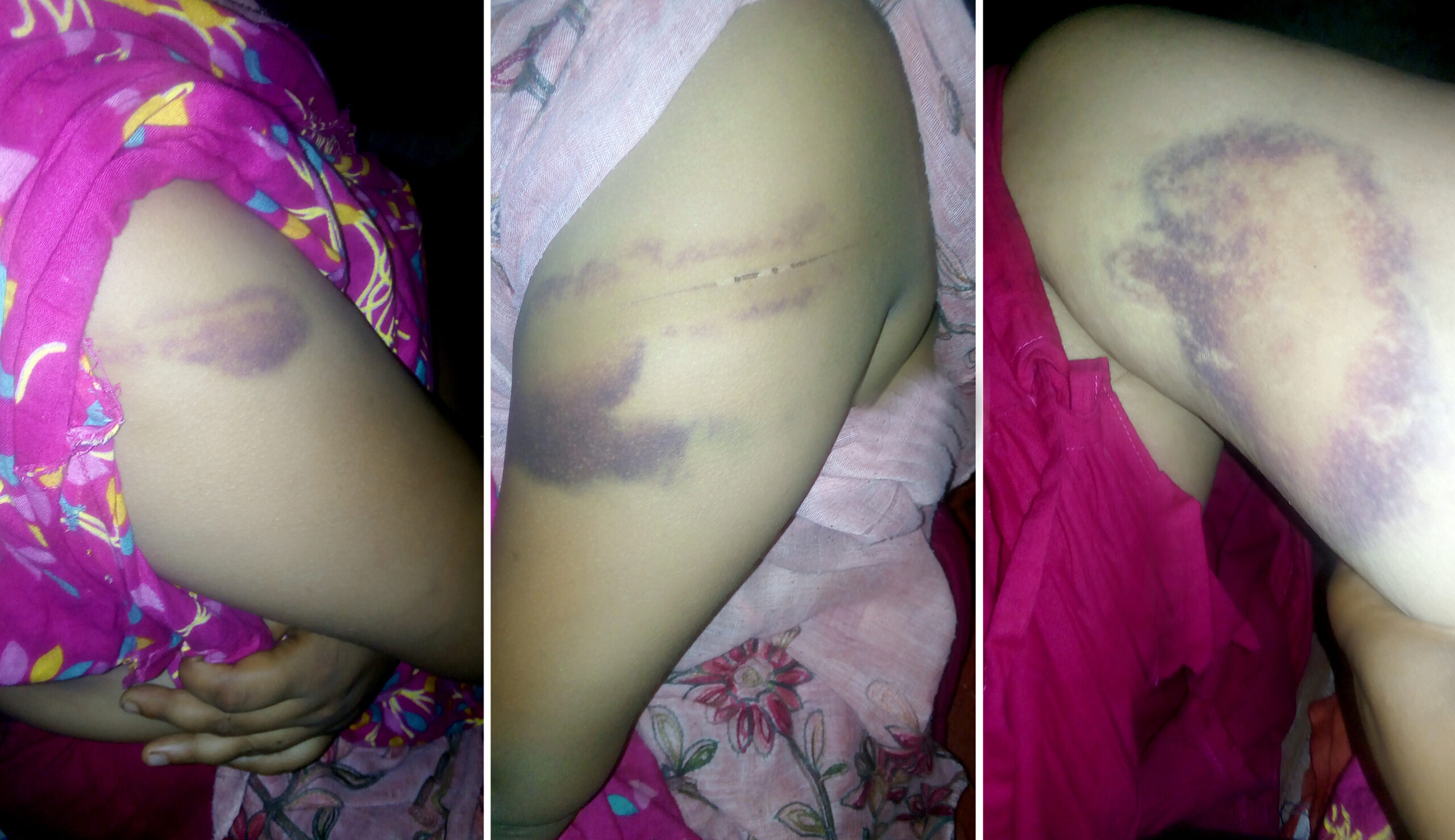 চকরিয়ায় বসতভিটা থেকে উচ্ছেদে নারীকে ধর্ষণচেষ্ঠা: শাররীক নির্যাতন