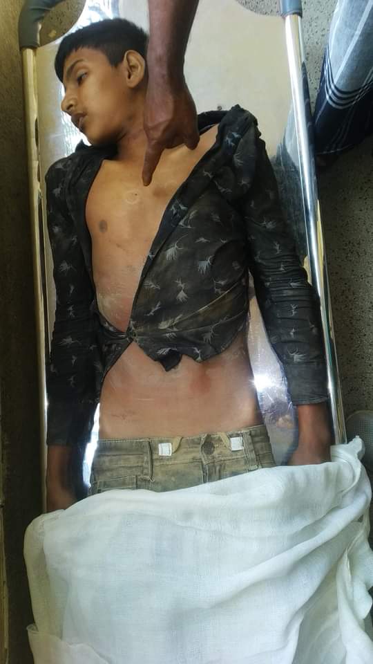 লামায় এক শিশু চালক ট্রলি চাপায় মৃত্যু