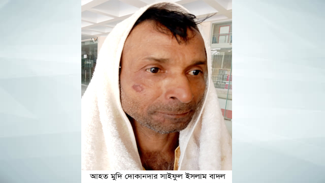 রামুতে বকেয়া টাকা চাওয়ায় মুদি দোকানদারের হাঁড় ভেঙ্গে দেয়ার অভিযোগ