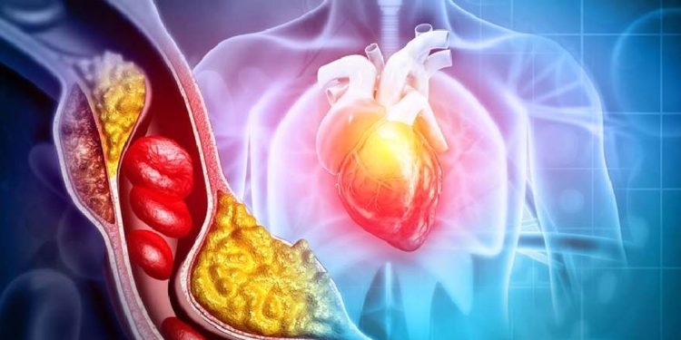 শরীরে কোলেস্টেরল বেড়েছে, বুঝবেন যেভাবে