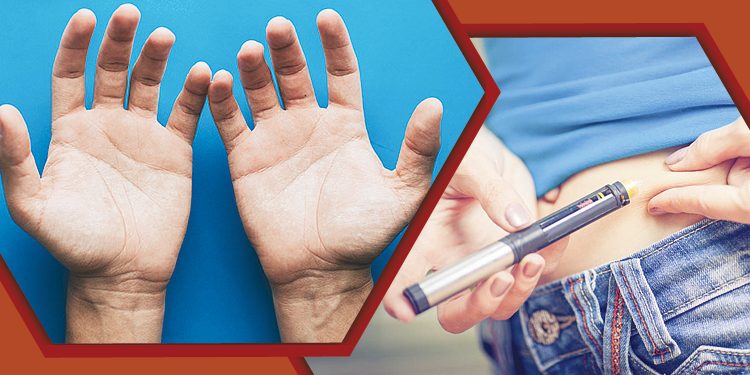 ডায়াবেটিস বাড়লে দেখা দেয় যেসব লক্ষণ