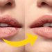 শীতে ঠোঁট ফাটার সমস্যা দূর করার ঘরোয়া উপায়