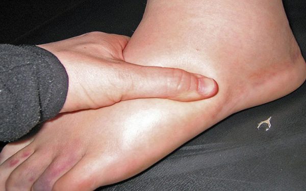 মাঝে মধ্যেই পা ফুলে যায়?