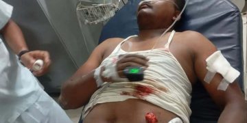 লামায় সিএনজি চালককে চুরি আঘাত করে গাড়ি নিয়ে পালাল ডাকাত দল