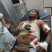 লামায় সিএনজি চালককে চুরি আঘাত করে গাড়ি নিয়ে পালাল ডাকাত দল